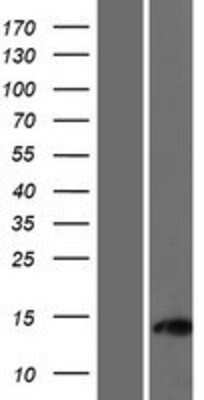 Western Blot: C11orf96 Overexpression Lysate [NBP2-09724]