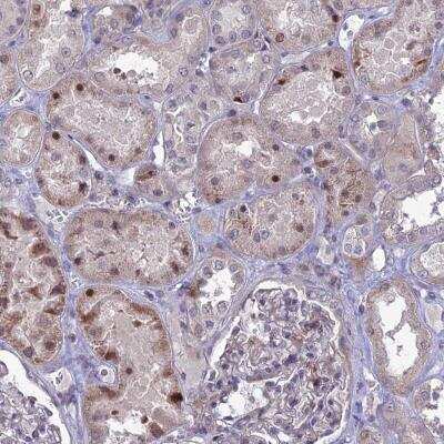 Immunohistochemistry-Paraffin: TMEM263 Antibody [NBP1-81182]