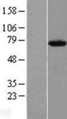 Western Blot: METTL25 Overexpression Lysate [NBL1-08132]