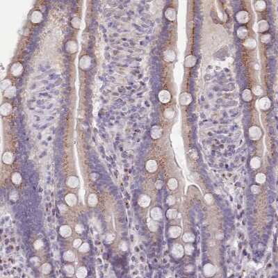 Immunohistochemistry-Paraffin: MYRFL Antibody [NBP2-14374]
