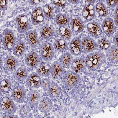 Immunohistochemistry-Paraffin: C12orf29 Antibody [NBP1-84177]