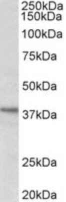 Western Blot: C12orf29 Antibody [NBP2-26131]