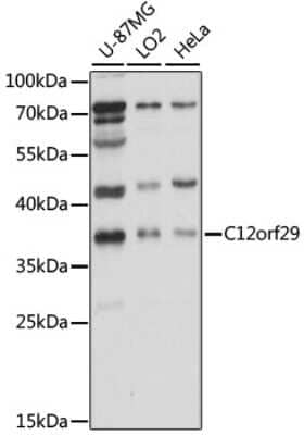 Western Blot: C12orf29 AntibodyAzide and BSA Free [NBP2-92281]