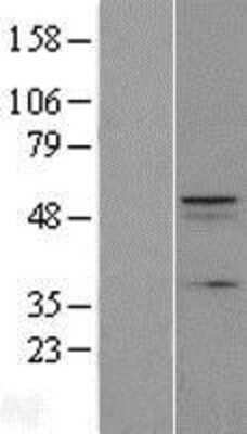 Western Blot: FAM222A Overexpression Lysate [NBL1-08137]