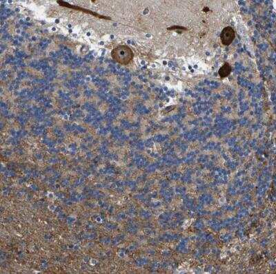 Immunohistochemistry-Paraffin: RESF1 Antibody [NBP1-90427]