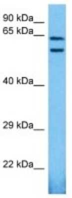 Western Blot: C12orf4 Antibody [NBP3-10860]