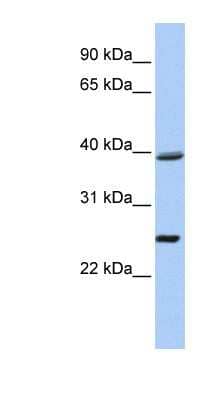 Western Blot: C12orf42 Antibody [NBP1-70431]