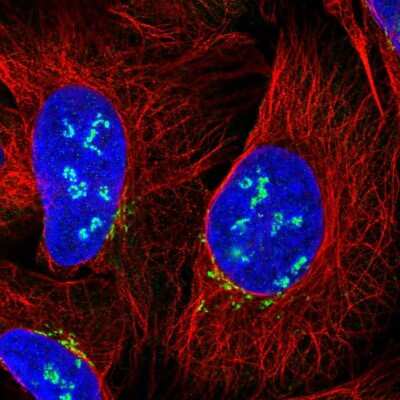 Immunocytochemistry/ Immunofluorescence: Custos Antibody [NBP2-57499]