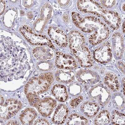 Immunohistochemistry-Paraffin: Custos Antibody [NBP1-91713]