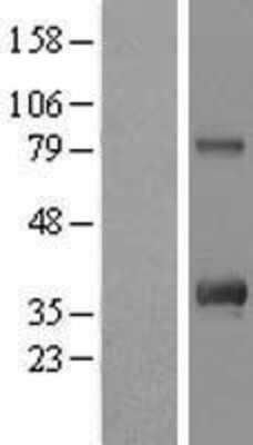 Western Blot: Custos Overexpression Lysate [NBL1-08142]