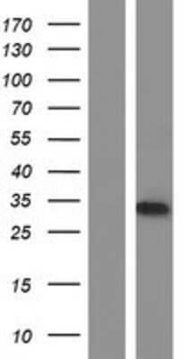 Western Blot: ATG101 Overexpression Lysate [NBP2-08327]