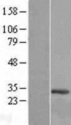 Western Blot: C12orf45 Overexpression Lysate [NBP2-05404]