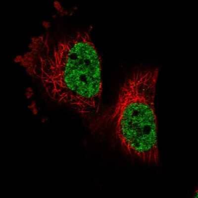 Immunocytochemistry/ Immunofluorescence: PARPBP Antibody [NBP1-93969]