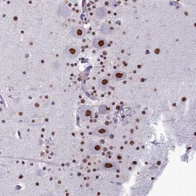 Immunohistochemistry-Paraffin: PARPBP Antibody [NBP1-93969]
