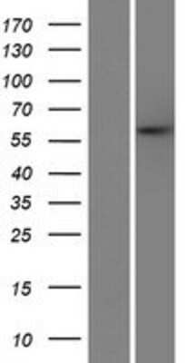 Western Blot: PARPBP Overexpression Lysate [NBP2-06899]