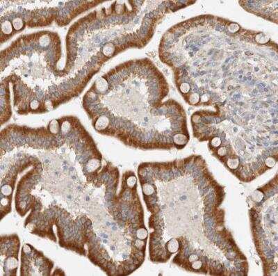 Immunohistochemistry-Paraffin: C12orf49 Antibody [NBP1-82144]