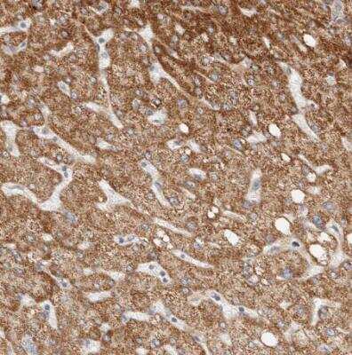 Immunohistochemistry-Paraffin: C12orf49 Antibody [NBP1-82144]