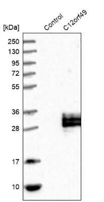 Western Blot: C12orf49 Antibody [NBP1-82144]