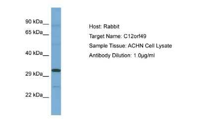 Western Blot: C12orf49 Antibody [NBP2-87035]