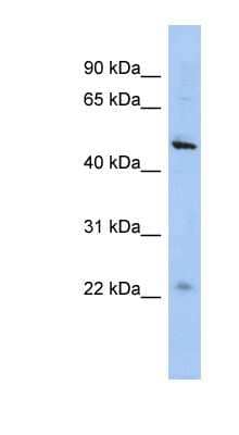 Western Blot: C12orf50 Antibody [NBP1-56725]