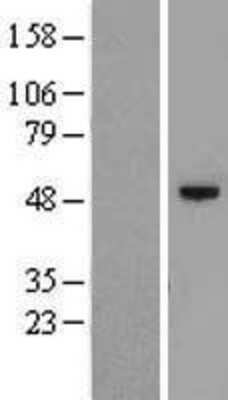 Western Blot: C12orf50 Overexpression Lysate [NBL1-08148]