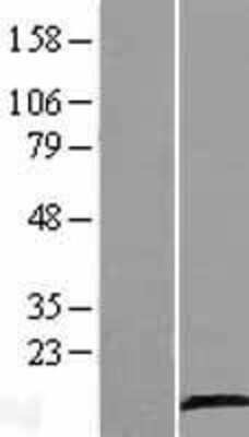 Western Blot: HSD29 Overexpression Lysate [NBL1-08152]