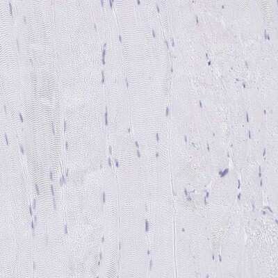 Immunohistochemistry-Paraffin: C12orf56 Antibody [NBP2-30788]