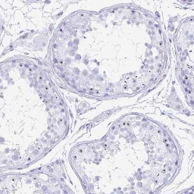 Immunohistochemistry-Paraffin: C12orf56 Antibody [NBP2-30788]