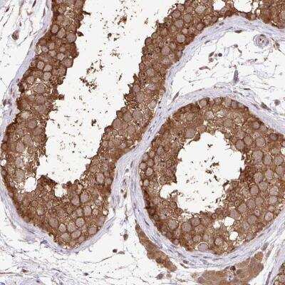 Immunohistochemistry-Paraffin: GRCC10 Antibody [NBP2-31752]