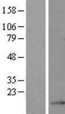 Western Blot: GRCC10 Overexpression Lysate [NBL1-08153]