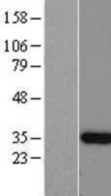 Western Blot: C12orf60 Overexpression Lysate [NBL1-08154]