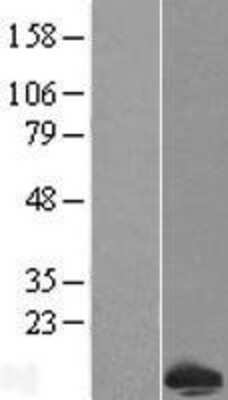 Western Blot: COX14 Overexpression Lysate [NBL1-08155]