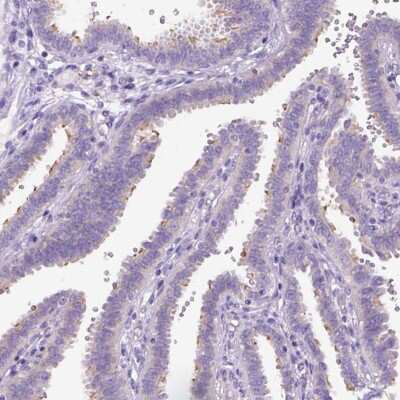 Immunohistochemistry-Paraffin: CFAP54 Antibody [NBP1-90737]