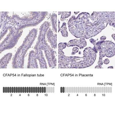 Immunohistochemistry-Paraffin: CFAP54 Antibody [NBP1-90737]