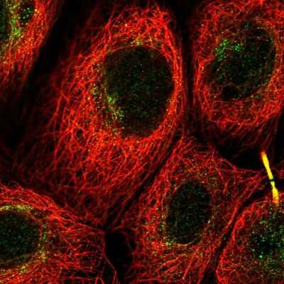 Immunocytochemistry/ Immunofluorescence: C12orf66 Antibody [NBP2-55499]