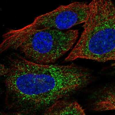 Immunocytochemistry/ Immunofluorescence: CCDC184 Antibody [NBP2-48747]