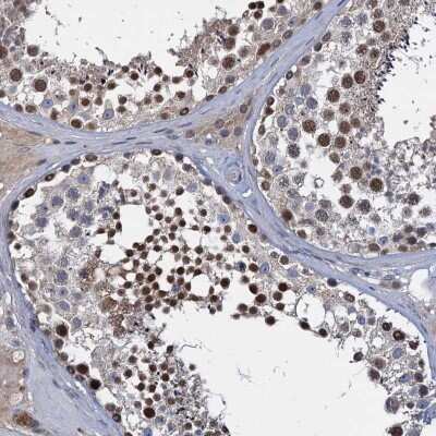 Immunohistochemistry: CCDC184 Antibody [NBP2-48717]