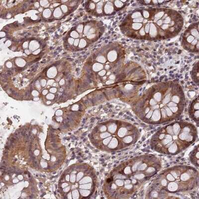 Immunohistochemistry-Paraffin: CCDC184 Antibody [NBP2-48747]