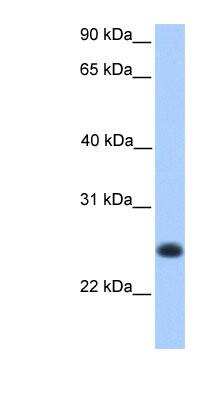 Western Blot: CCDC184 Antibody [NBP1-70432]