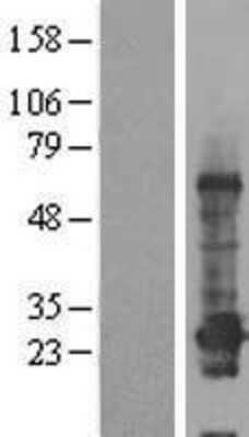 Western Blot: CCDC184 Overexpression Lysate [NBP2-08724]