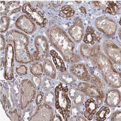 Immunohistochemistry: SMCO3 Antibody [NBP2-30445]