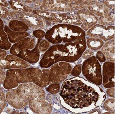 Immunohistochemistry: SMCO3 Antibody [NBP2-30513]