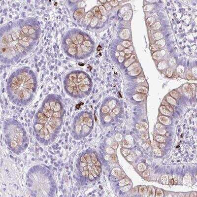 Immunohistochemistry-Paraffin: C12orf71 Antibody [NBP2-32397]