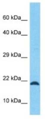 Western Blot: C12orf74 Antibody [NBP3-10752]