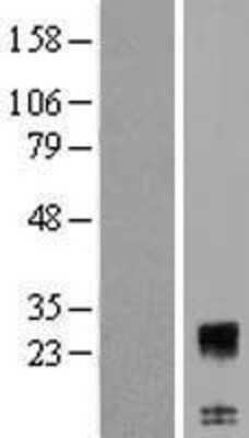 Western Blot: C12orf74 Overexpression Lysate [NBP2-08556]
