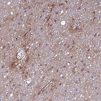 Immunohistochemistry-Paraffin: P2X7/P2RX7 Antibody [NBP2-14515]