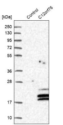 Western Blot: C12orf76 Antibody [NBP2-48714]