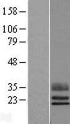 Western Blot: TEX29 Overexpression Lysate [NBL1-08158]