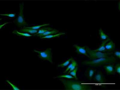 Immunocytochemistry/ Immunofluorescence: RUBCNL Antibody [H00080183-D01P]