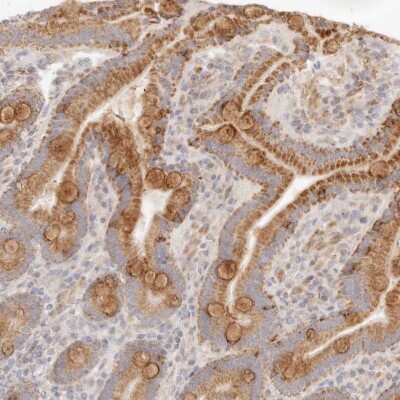 Immunohistochemistry-Paraffin: RUBCNL Antibody [NBP1-82141]